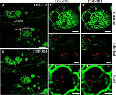 High Dynamic Range Structured Illumination Microscope Based on Multiple Exposures